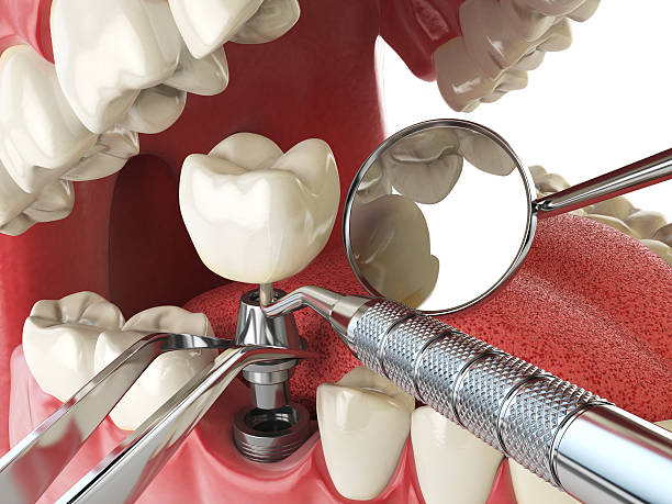 Best After-Hours Emergency Dentist in Grandwood Park, IL