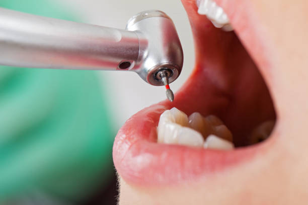 Best Emergency Root Canal Treatment in Grandwood Park, IL